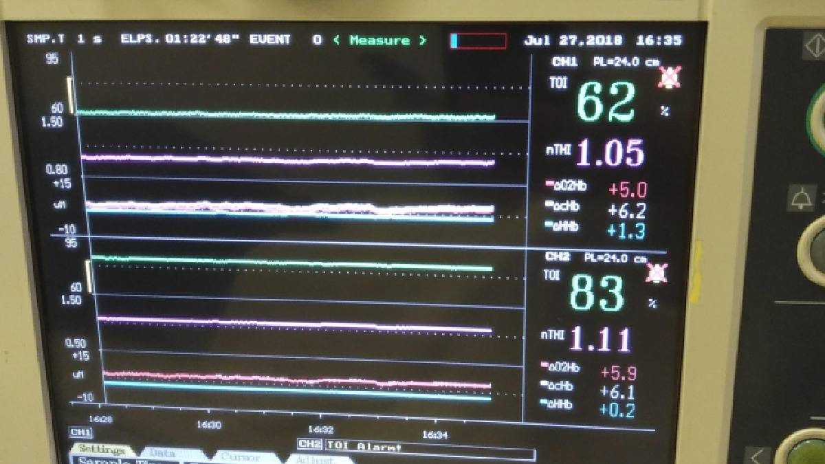 近赤外線分光法（NIRS）測定機器 HAMAMATSU NIRO-200